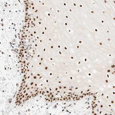Immunohistochemistry-Paraffin: Pygopus-2 Antibody [NBP1-87548]
