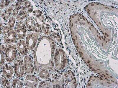 Immunohistochemistry-Paraffin: Pygopus-2 Antibody [NBP2-20019]