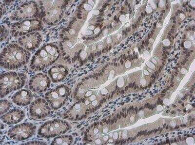 Immunohistochemistry-Paraffin: Pygopus-2 Antibody [NBP2-20019]
