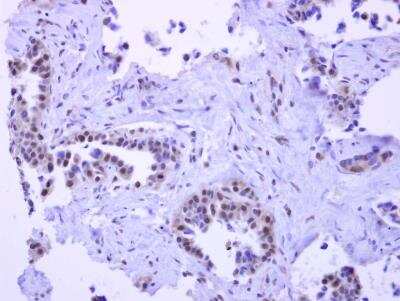 Immunohistochemistry-Paraffin: Pygopus-2 Antibody [NBP2-20020]
