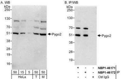 Western Blot: Pygopus-2 Antibody [NBP1-46171]