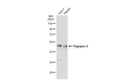 Western Blot: Pygopus-2 Antibody [NBP2-20019]