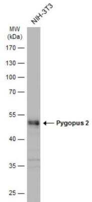 Western Blot: Pygopus-2 Antibody [NBP2-20019]