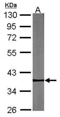 Western Blot: Pygopus-2 Antibody [NBP2-20020]