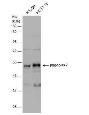 Western Blot: Pygopus-2 Antibody [NBP2-20020]