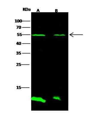 Western Blot: Pyrethroid hydrolase Ces2e Antibody [NBP3-06082]