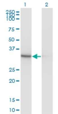 Western Blot: Pyridoxal Kinase/PDXK Antibody (4G6) [H00008566-M03]