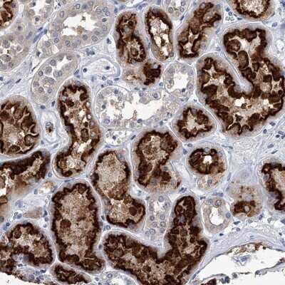 Immunohistochemistry-Paraffin: Pyridoxal Kinase/PDXK Antibody [NBP1-88282]