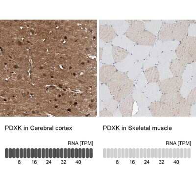 Immunohistochemistry-Paraffin: Pyridoxal Kinase/PDXK Antibody [NBP1-88284]