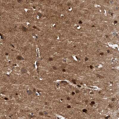 Immunohistochemistry-Paraffin: Pyridoxal Kinase/PDXK Antibody [NBP1-88284]