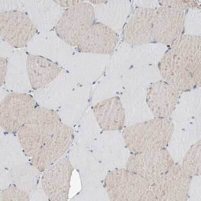 Immunohistochemistry-Paraffin: Pyridoxal Kinase/PDXK Antibody [NBP1-88284]