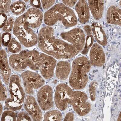 Immunohistochemistry-Paraffin: Pyridoxal Kinase/PDXK Antibody [NBP1-88284]