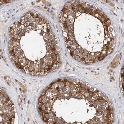 Immunohistochemistry-Paraffin: Pyridoxal Kinase/PDXK Antibody [NBP1-88284]