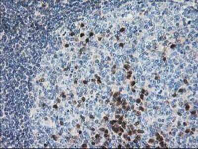 Immunohistochemistry: Pyridoxal Kinase/PDXK Antibody (OTI5H5) - Azide and BSA Free [NBP2-73754]