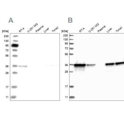 Western Blot: Pyridoxal Kinase/PDXK Antibody [NBP1-88282]