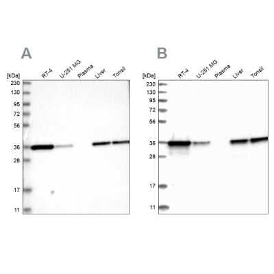 Western Blot: Pyridoxal Kinase/PDXK Antibody [NBP1-88283]