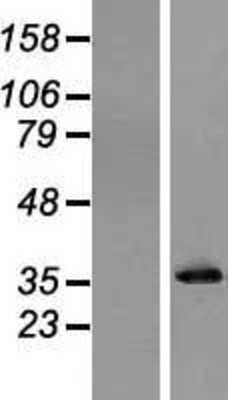 Western Blot: Inorganic Pyrophosphatase/PPA1 Overexpression Lysate [NBL1-14622]