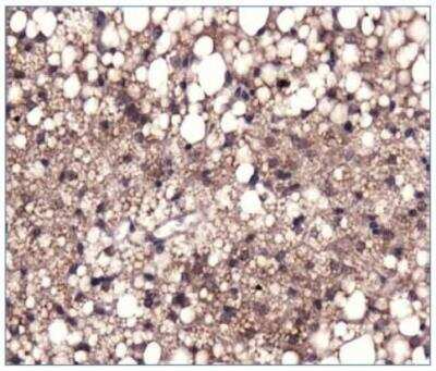 Immunohistochemistry-Paraffin: Pyruvate Carboxylase Antibody - BSA Free [NBP1-49536]