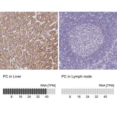 Immunohistochemistry-Paraffin: Pyruvate Carboxylase Antibody [NBP2-33407]
