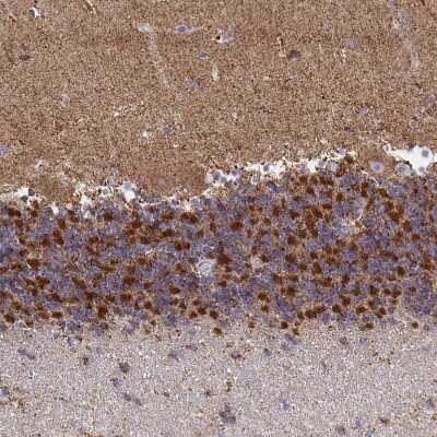 Immunohistochemistry-Paraffin: Pyruvate Carboxylase Antibody [NBP2-33407]