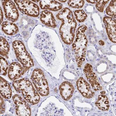 Immunohistochemistry-Paraffin: Pyruvate Carboxylase Antibody [NBP2-33407]
