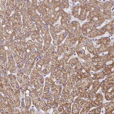 Immunohistochemistry-Paraffin: Pyruvate Carboxylase Antibody [NBP2-33407]