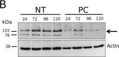 Knockdown Validated: Pyruvate Carboxylase Antibody - BSA Free [NBP1-49536]