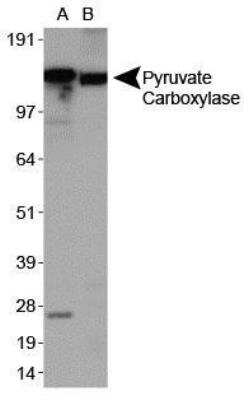 Western Blot: Pyruvate Carboxylase AntibodyBSA Free [NBP1-49536]