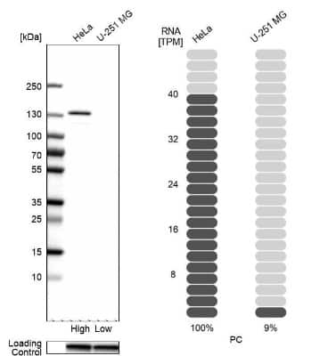 Western Blot: Pyruvate Carboxylase Antibody [NBP2-33407]