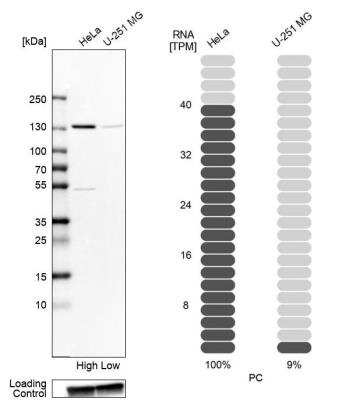 Western Blot: Pyruvate Carboxylase Antibody [NBP2-55361]