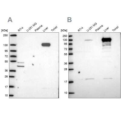 Western Blot: Pyruvate Carboxylase Antibody [NBP2-55361]