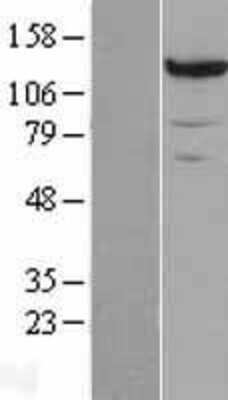 Western Blot: Pyruvate Carboxylase Overexpression Lysate [NBL1-14138]