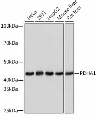 Western Blot: Pyruvate Dehydrogenase E1-alpha subunit Antibody (8Z4N6) [NBP3-15470]