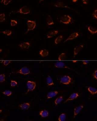 Immunocytochemistry/ Immunofluorescence: Pyruvate Dehydrogenase E1-alpha subunit Antibody - Azide and BSA Free [NBP2-95253]