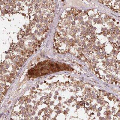 Immunohistochemistry-Paraffin: Pyruvate Dehydrogenase E1-alpha subunit Antibody [NBP2-54747]