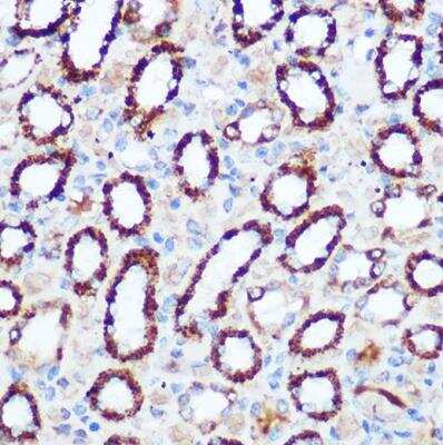 Immunohistochemistry-Paraffin: Pyruvate Dehydrogenase E1-alpha subunit Antibody - Azide and BSA Free [NBP2-95251]