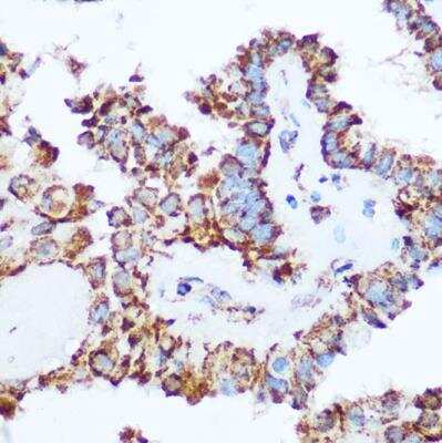 Immunohistochemistry-Paraffin: Pyruvate Dehydrogenase E1-alpha subunit Antibody - Azide and BSA Free [NBP2-95251]