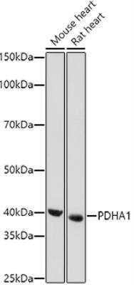 Western Blot: Pyruvate Dehydrogenase E1-alpha subunit AntibodyAzide and BSA Free [NBP2-95251]