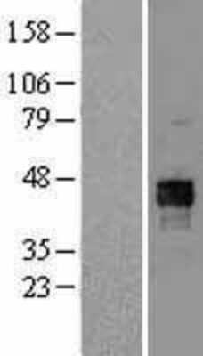 Western Blot: Pyruvate Dehydrogenase E1-alpha subunit Overexpression Lysate [NBL1-14241]