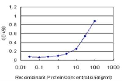 ELISA: Pyruvate Dehydrogenase E1 beta subunit Antibody (2B2) [H00005162-M03]