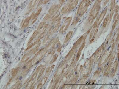 Immunohistochemistry-Paraffin: Pyruvate Dehydrogenase E1 beta subunit Antibody (2B2) [H00005162-M03]