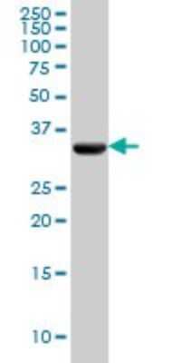 Western Blot: Pyruvate Dehydrogenase E1 beta subunit Antibody (2B2) [H00005162-M03]