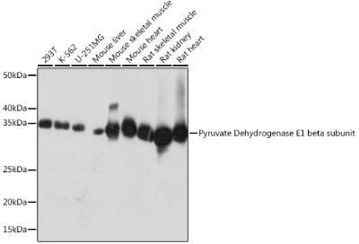 Western Blot: Pyruvate Dehydrogenase E1 beta subunit Antibody (7V8O5) [NBP3-16455]