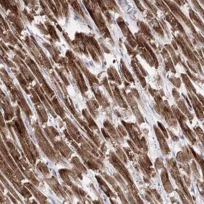 Immunohistochemistry-Paraffin: Pyruvate Dehydrogenase E1 beta subunit Antibody [NBP1-87421]