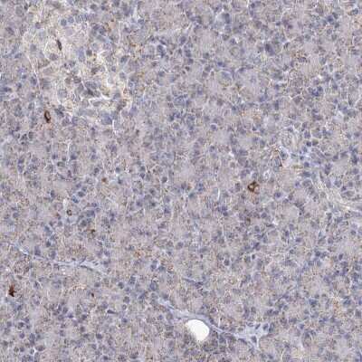 Immunohistochemistry-Paraffin: Pyruvate Dehydrogenase E1 beta subunit Antibody [NBP1-87421]