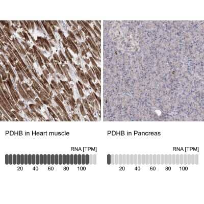 Immunohistochemistry-Paraffin: Pyruvate Dehydrogenase E1 beta subunit Antibody [NBP1-87421]