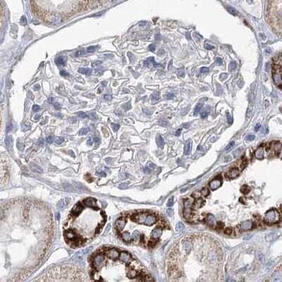 Immunohistochemistry-Paraffin: Pyruvate Dehydrogenase E1 beta subunit Antibody [NBP1-87421]