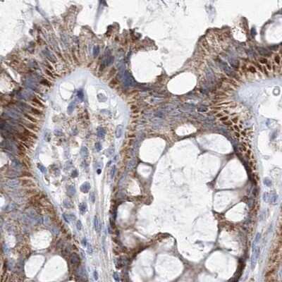 Immunohistochemistry-Paraffin: Pyruvate Dehydrogenase E1 beta subunit Antibody [NBP1-87421]