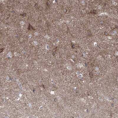 Immunohistochemistry-Paraffin: Pyruvate Dehydrogenase E1 beta subunit Antibody [NBP1-87421]