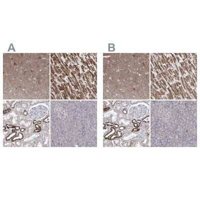 Immunohistochemistry-Paraffin: Pyruvate Dehydrogenase E1 beta subunit Antibody [NBP1-87421]